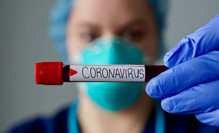 coronavirus covid 19